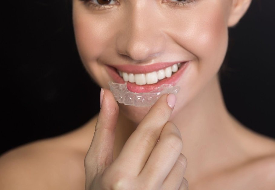 Invisalign Treatment Process